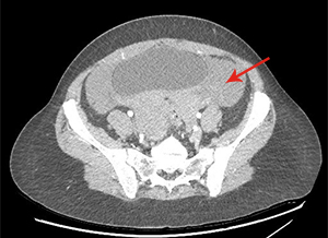 Question 1 answer - Image A
