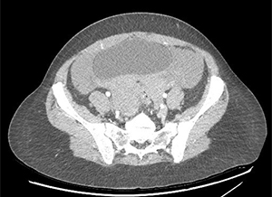 Question 1 - Image A