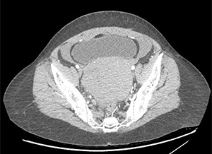 Question 1 - Image B