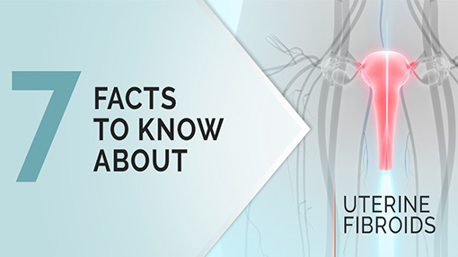 7 Facts to know about uterine fibroids