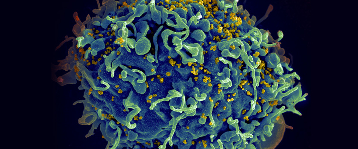 electron microscope image