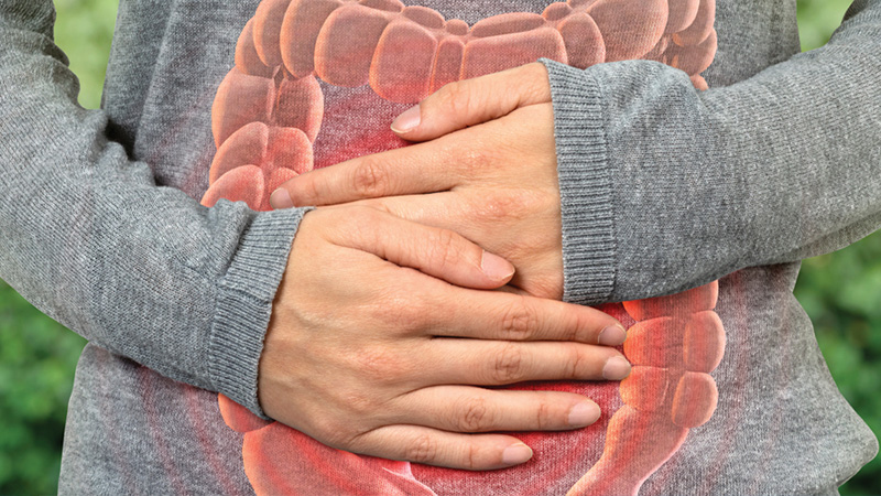 A gastroenterologist breaks down the symptoms, causes, and treatments for irritable bowel syndrome.