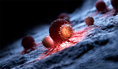 Innovations in Review: Oncology (Cancer)