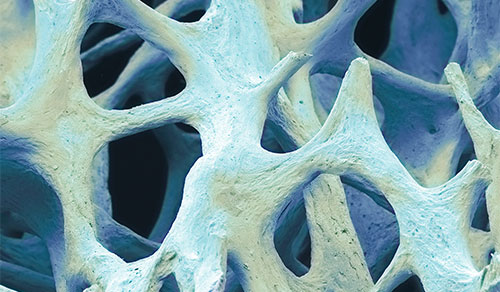 Innovations in Review: Orthopedics