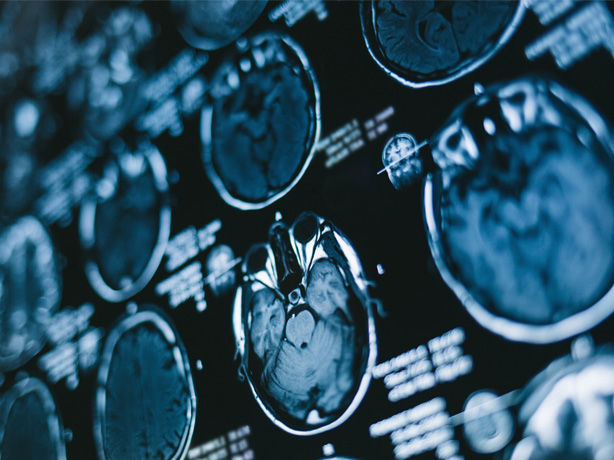 Innovations in Review: Neurology & Neurosurgery