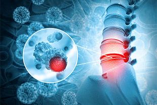 Rendered spine diagram showing bacteria